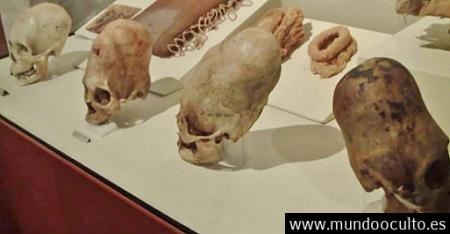 Los #craneos de #paracas: El analisis de ADN indica que no son humanos Los #craneos de #paracas: El analisis de ADN indica que no son humanos