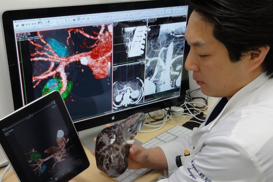 Imprimen tejidos de hígado humano en 3-D