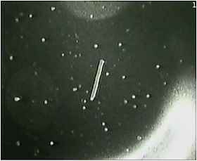 El incidente que oculto la NASA “Tether Incident”. El incidente que oculto la NASA “Tether Incident”.
