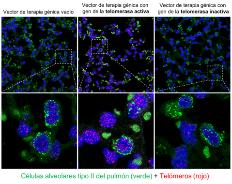 Detener el envejecimiento Prueban que la terapia génica con telomerasa no aumenta el riesgo de cáncer