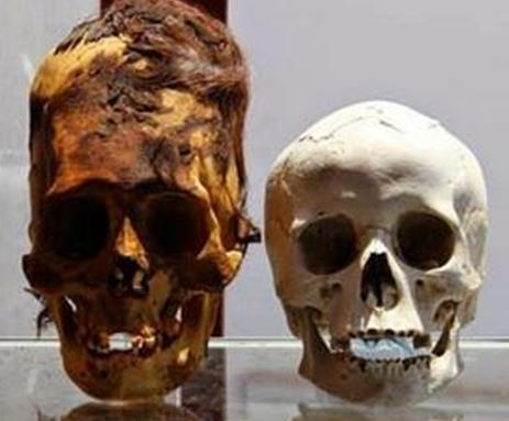 Diferencias entre los craneos cabeza cono y los nuestros   