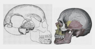 El Hombre de Boskop El Hombre de Boskop