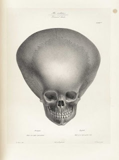 El Hombre de Boskop El Hombre de Boskop