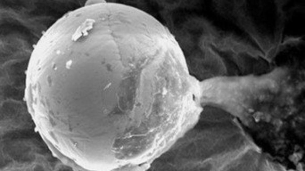 Hallan una posible ‘semilla’ alienígena en una esfera de metal Hallan una posible ‘semilla’ alienígena en una esfera de metal