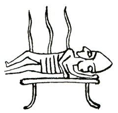 Radioterapia en la antigüedad
