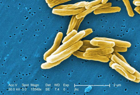 Peligro Mundial: Nadie Estará A Salvo En La Era Post-AntibióTica