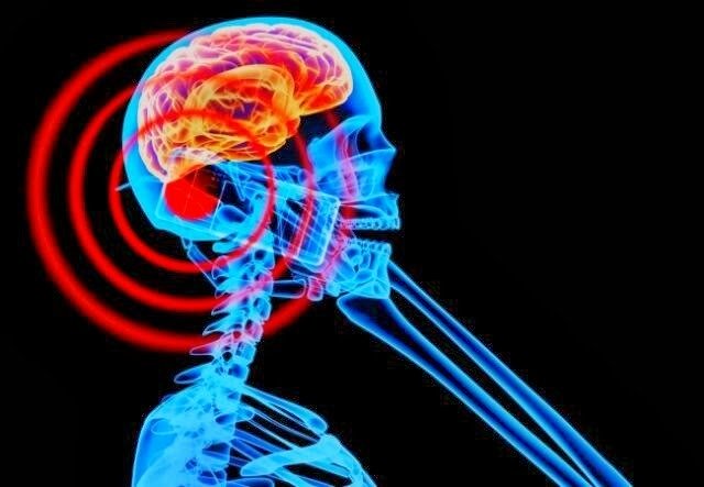 Médico australiano: “Los teléfonos móviles están directamente relacionados con el cáncer cerebral”