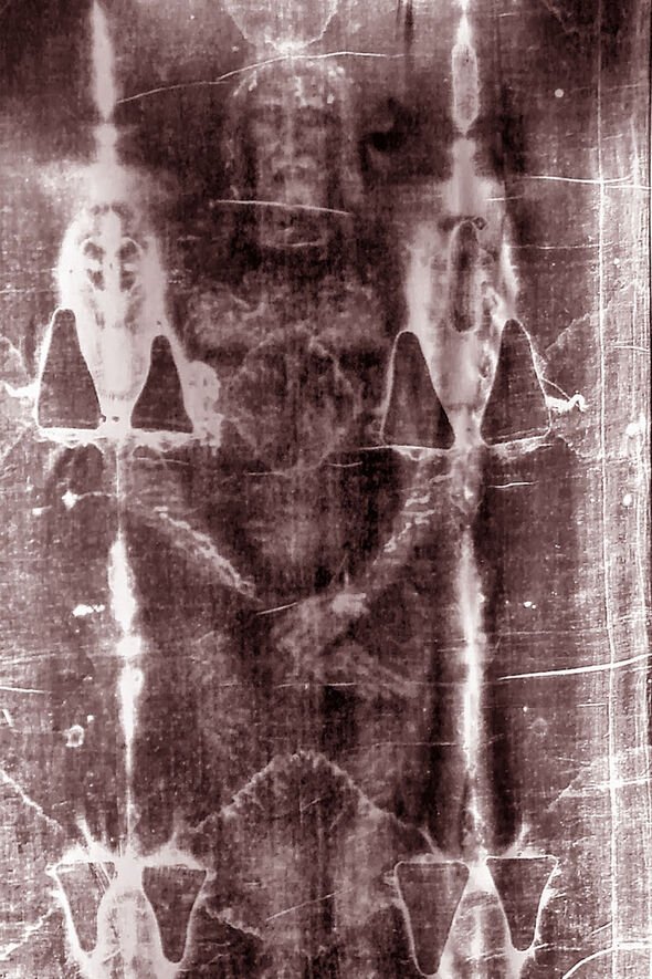 Historia: Las imágenes de la Sábana Santa representan a un hombre con las manos cruzadas sobre su cuerpo.