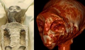 No hay señales de engaño: le realizaron tomografía computarizada a un “extraterrestre” de Perú