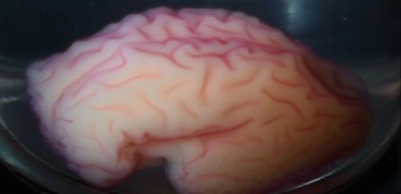 Los biólogos han impreso por primera vez tejido cerebral funcional en 3D. ¿A toda velocidad para los trasplantes de cabeza? 1