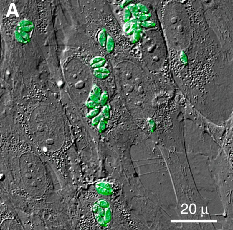 Toxoplasma gondii intracelular (en verde), dentro de fibroblastos humanos. (Microscopio de contraste de fases)
