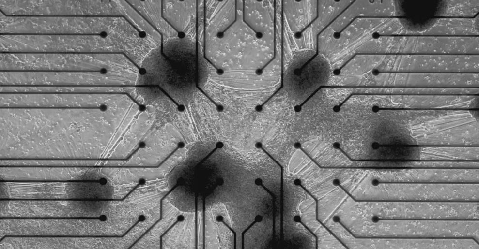 Células cerebrales humanas reales, que viven en un chip de silicio entre una serie de electrodos de entrada/salida.