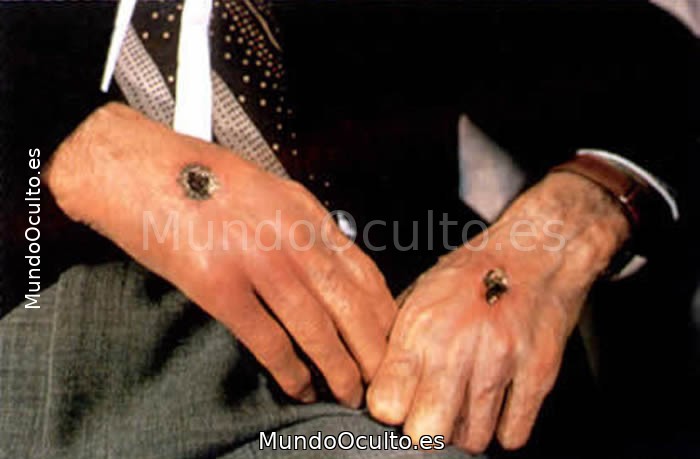 Misterio De Los Estigmatizados: Marcas de Fe
